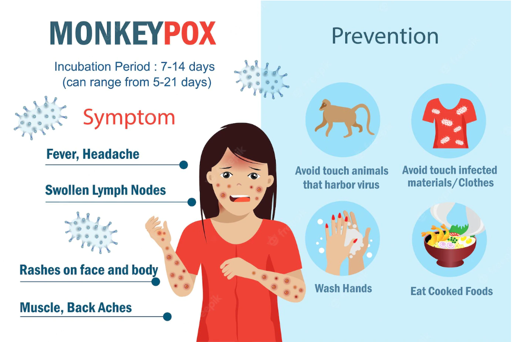 Monkeypox symptoms and prevention Infographic